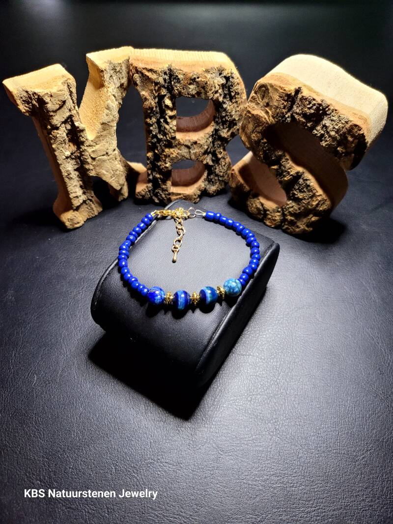 KBS Bracelet.3