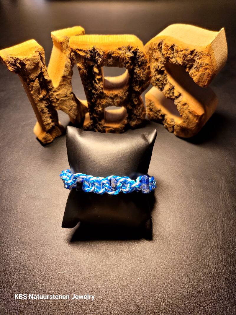 KBS Button Bracelet.2
