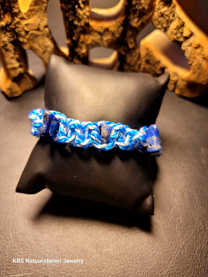 KBS Button Bracelet.2