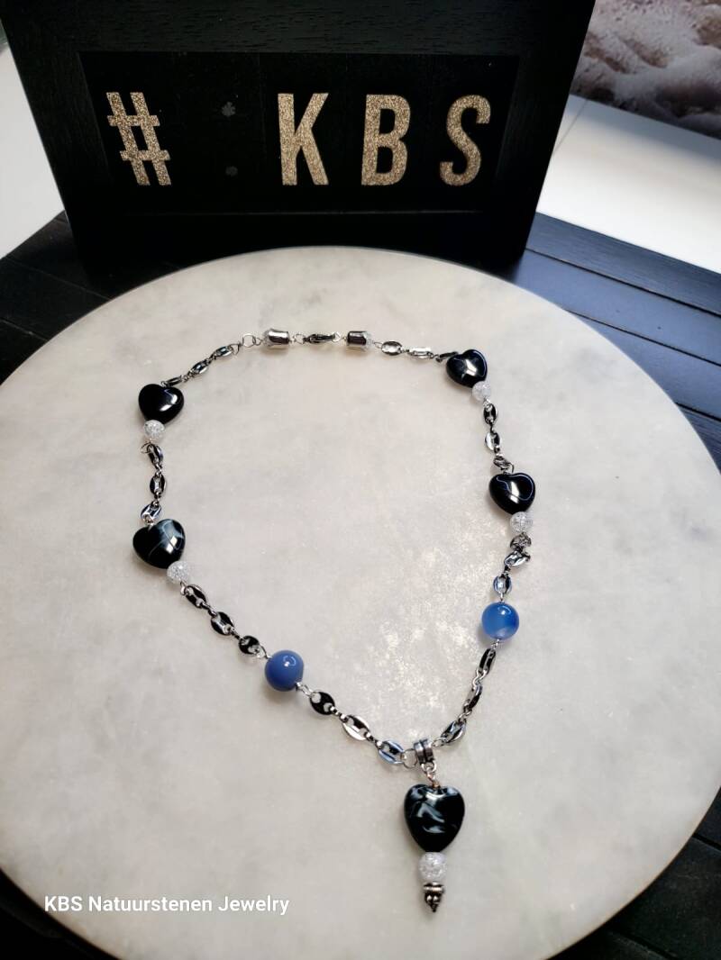 KBS